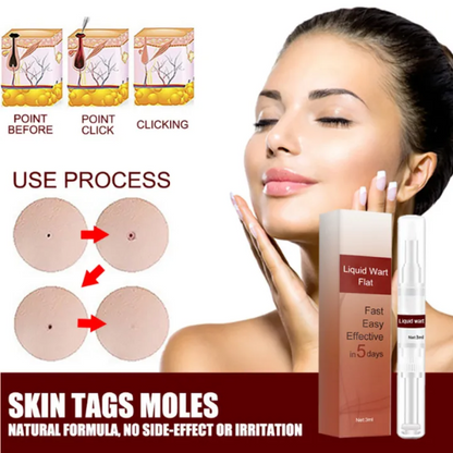 SkinClean™ Clear Skin WITHOUT SURGERY or Scars!