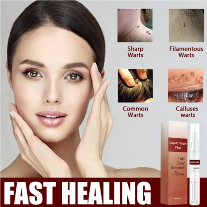 SkinClean™ Clear Skin WITHOUT SURGERY or Scars!