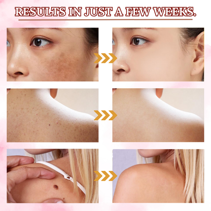 SkinClean™ Clear Skin WITHOUT SURGERY or Scars!